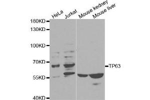 Image no. 1 for anti-Tumor Protein P63 (TP63) antibody (ABIN3023012)