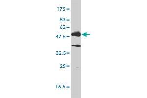 Image no. 1 for anti-Lymphocyte-Specific Protein tyrosine Kinase (LCK) (AA 1-539) antibody (ABIN561649)