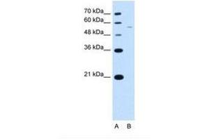 Image no. 2 for anti-arginine/serine-Rich Coiled-Coil 2 (RSRC2) (AA 363-412) antibody (ABIN321837)