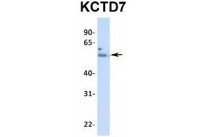 Image no. 2 for anti-Potassium Channel Tetramerisation Domain Containing 7 (KCTD7) (N-Term) antibody (ABIN2776287)
