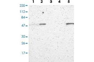 Western Blot analysis of (1) Human RT-4 cell, (2) Human U-251MG cell, (3) Human plasma, (4) Human liver tissue, (5) Human tonsil tissue.
