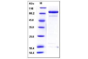 Image no. 1 for Calcium/calmodulin-Dependent Protein Kinase II alpha (CAMK2A) (AA 1-478) (Active) protein (GST tag) (ABIN2003179)
