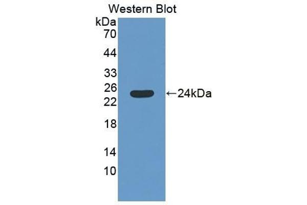SAT1 anticorps  (AA 1-171)