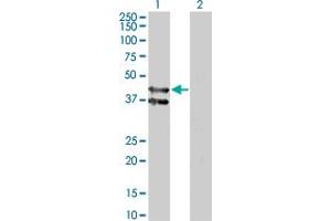 anti-Transmembrane Protein, Adipocyte Asscociated 1 (TPRA1) (AA 281-371) antibody