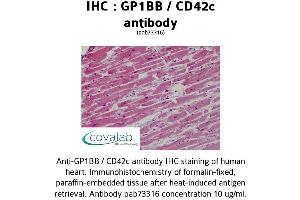 Image no. 2 for anti-Glycoprotein Ib (Platelet), beta Polypeptide (GP1BB) (AA 56-118) antibody (ABIN1734865)