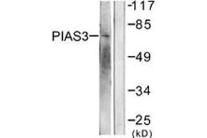 Image no. 1 for anti-Protein Inhibitor of Activated STAT, 3 (PIAS3) (AA 10-59) antibody (ABIN1533434)
