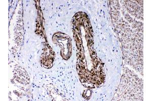 Image no. 6 for anti-Protein Phosphatase 1, Regulatory (Inhibitor) Subunit 14A (PPP1R14A) (AA 30-126) antibody (ABIN5518865)