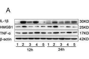 Image no. 3 for anti-Interleukin 1, beta (IL1B) antibody (ABIN3021462)