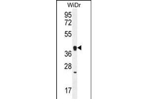 OR2T8 antibody  (C-Term)