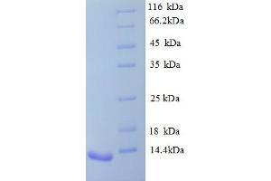 Image no. 1 for Arginine Vasopressin Receptor 1B (AVPR1B) (AA 343-425), (partial) protein (His tag) (ABIN5712992)