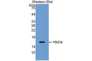 Image no. 1 for anti-Transmembrane Protein 27 (TMEM27) (AA 15-135) antibody (ABIN1871663)