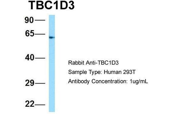 TBC1D3 抗体  (C-Term)