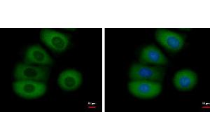 Image no. 3 for anti-Fibroblast Growth Factor Receptor 1 (FGFR1) (C-Term) antibody (ABIN2854680)