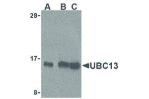 Image no. 1 for anti-Ubiquitin-Conjugating Enzyme E2N (UBE2N) (C-Term) antibody (ABIN6656811)