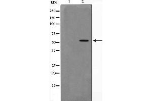 Image no. 1 for anti-Dihydrouridine Synthase 2-Like (DUS2L) antibody (ABIN6261379)