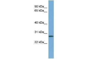 Image no. 1 for anti-Cyclin D-Type Binding-Protein 1 (CCNDBP1) (Middle Region) antibody (ABIN2786197)