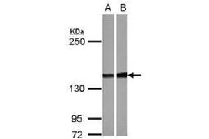 Image no. 2 for anti-Protein Phosphatase 2, Regulatory Subunit B'', alpha (PPP2R3A) (C-Term) antibody (ABIN1491841)