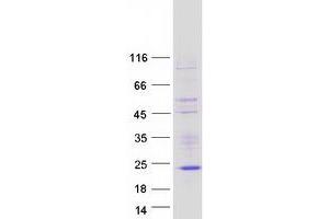 Image no. 1 for NK6 Homeobox 3 (NKX6-3) protein (Myc-DYKDDDDK Tag) (ABIN2727383)