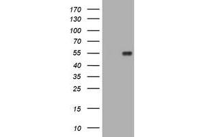 Image no. 8 for anti-Mucin 1 (MUC1) antibody (ABIN1499598)