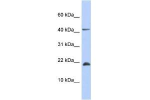Image no. 1 for anti-SFRS12-Interacting Protein 1 (SFRS12IP1) (Middle Region) antibody (ABIN2786333)
