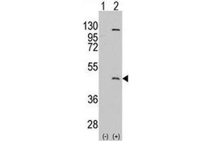 Image no. 3 for anti-Protein Arginine Methyltransferase 8 (PRMT8) (AA 344-373) antibody (ABIN3032366)
