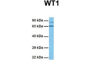 Image no. 5 for anti-Wilms Tumor 1 (WT1) (Middle Region) antibody (ABIN2780340)