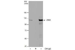 Image no. 2 for anti-Zinc Fingers and Homeoboxes 2 (ZHX2) (C-Term) antibody (ABIN2856852)