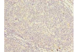 Immunohistochemistry of paraffin-embedded human tonsil tissue using ABIN7164637 at dilution of 1:100