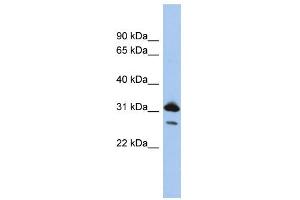 Image no. 1 for anti-RAP1B, Member of RAS Oncogene Family (RAP1B) (N-Term) antibody (ABIN2786568)