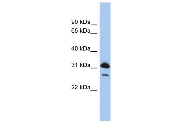 anti-RAP1B, Member of RAS Oncogene Family (RAP1B) (N-Term) antibody