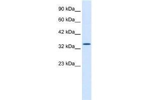 Image no. 6 for anti-Hematopoietically Expressed Homeobox (HHEX) (Middle Region) antibody (ABIN2777302)