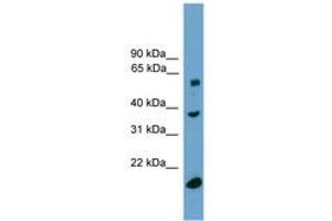 Image no. 1 for anti-Transducin (Beta)-Like 1, Y-Linked (TBL1Y) (C-Term) antibody (ABIN6744913)