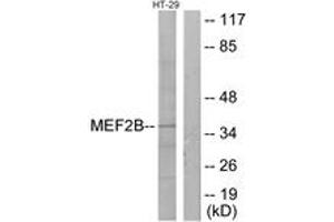 Image no. 1 for anti-Myocyte Enhancer Factor 2B (MEF2B) (AA 51-100) antibody (ABIN1533819)
