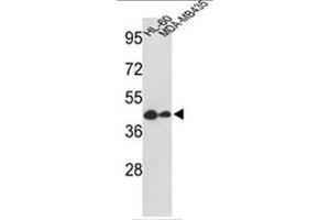 Image no. 1 for anti-Gasdermin B (GSDMB) (Middle Region) antibody (ABIN453671)