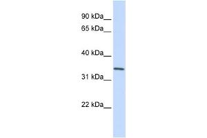 Image no. 1 for anti-Glucosamine-6-Phosphate Deaminase 1 (GNPDA1) (C-Term) antibody (ABIN2783314)
