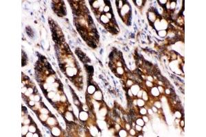 IHC-P: Caspase-6 antibody testing of rat intestine tissue