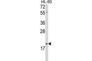 Image no. 1 for anti-delta-Like 2 Homolog (DLK2) antibody (ABIN3004005)