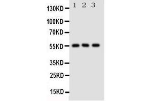 Image no. 3 for anti-Solute Carrier Family 2 (Facilitated Glucose/fructose Transporter), Member 5 (SLC2A5) (AA 232-251), (Middle Region) antibody (ABIN3044131)