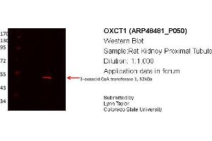 Image no. 2 for anti-3-Oxoacid CoA Transferase 1 (OXCT1) (Middle Region) antibody (ABIN2783388)