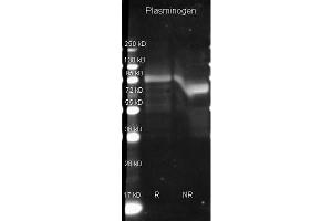 Image no. 1 for anti-Plasminogen (PLG) antibody (ABIN105701)