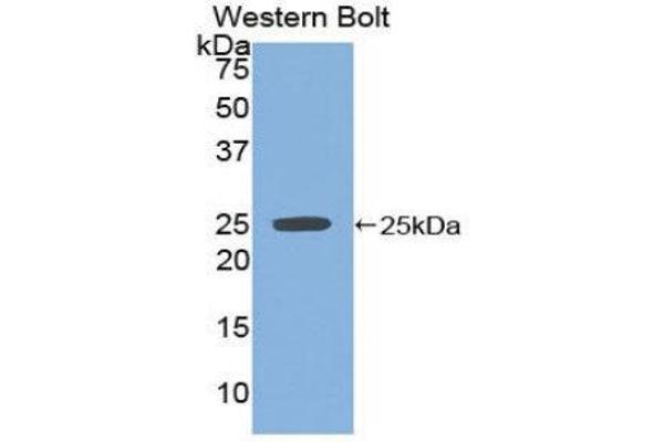 anti-Sprouty Homolog 2 (SPRY2) (AA 116-304) antibody