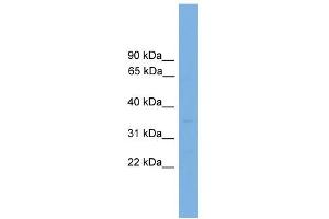 WB Suggested Anti-PCGF1 Antibody Titration:  0.