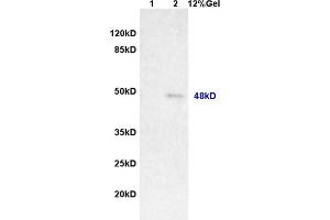 Image no. 1 for anti-Melanoma Antigen Family A, 11 (MAGEA11) (AA 12-120) antibody (ABIN721285)