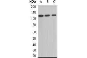 Image no. 2 for anti-alpha Ketoglutarate Dehydrogenase (alphaKGDHC) antibody (ABIN2966857)