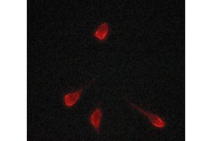 Image no. 4 for anti-Tyrosinase (TYR) antibody (ABIN6265828)