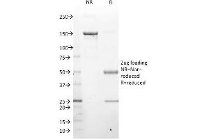 Image no. 5 for anti-LIM Domain Only 2 (Rhombotin-Like 1) (LMO2) (AA 23-140) antibody (ABIN6939966)