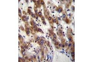 Image no. 1 for anti-PHD Finger Protein 20 (PHF20) (AA 130-159), (N-Term) antibody (ABIN954119)