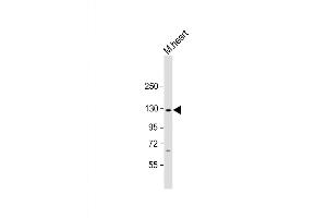 Image no. 1 for anti-NLR Family, Pyrin Domain Containing 6 (NLRP6) (AA 343-372) antibody (ABIN5531699)