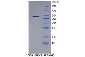 Image no. 1 for Kallikrein 1 (KLK1) (AA 21-261) protein (His tag) (ABIN1980873)
