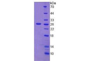Image no. 1 for Desmoplakin (DSP) (AA 2609-2822) protein (His tag) (ABIN6236843)